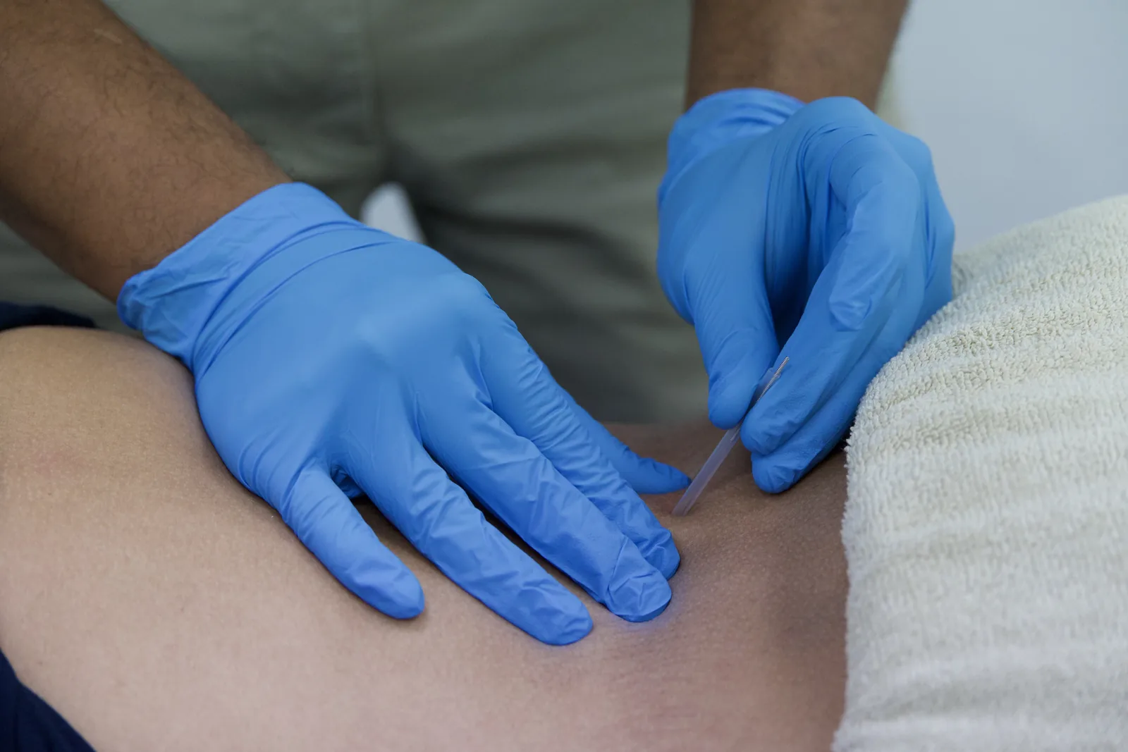 Gloved hands placing a dry needle in a patient's back